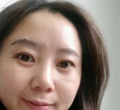 去眼袋手术