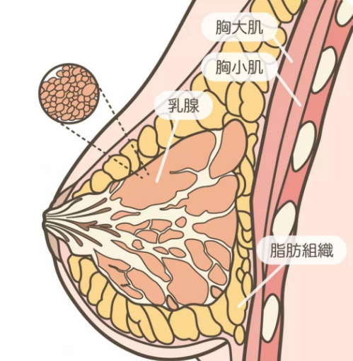 自体脂肪丰胸