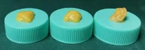自体脂肪丰胸