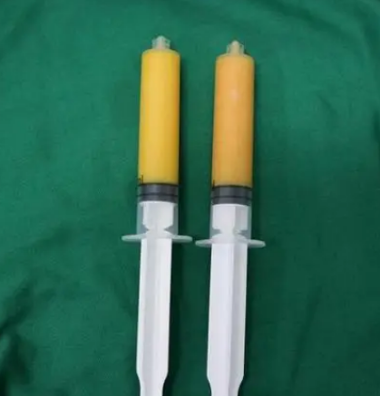 自体脂肪丰胸