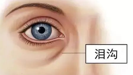 泪沟