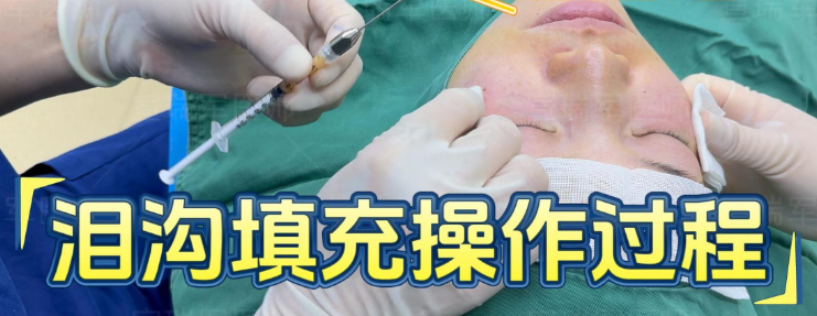 泪沟