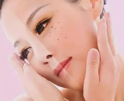 皮肤