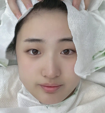 皮肤