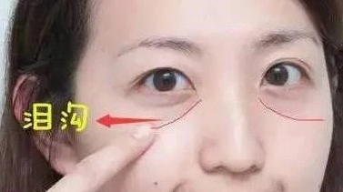自体脂肪填充