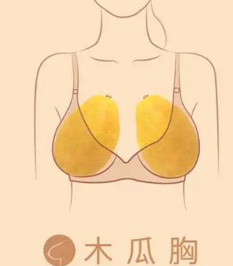 自体脂肪填充