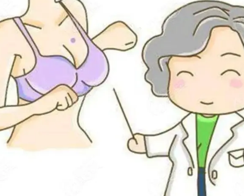 自体脂肪填充