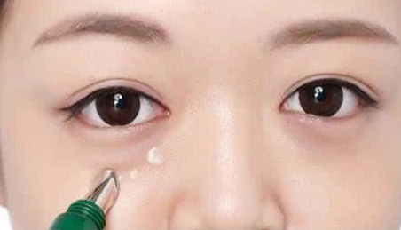 自体脂肪填充