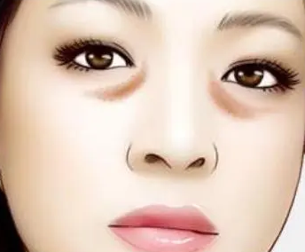 自体脂肪填充