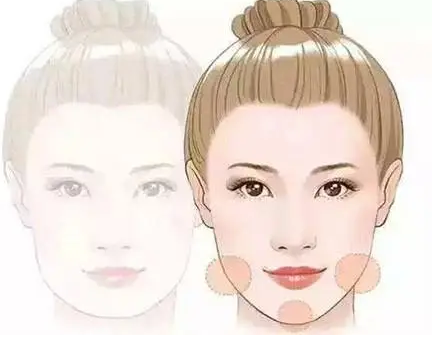 自体脂肪填充