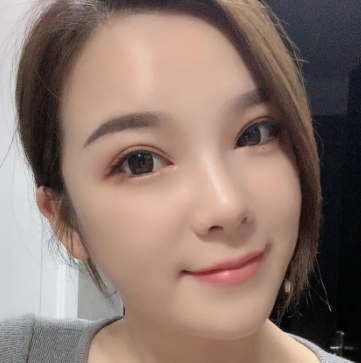 自体脂肪填充
