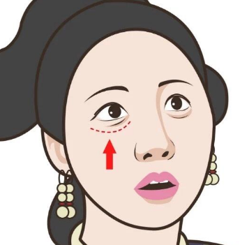 眼袋