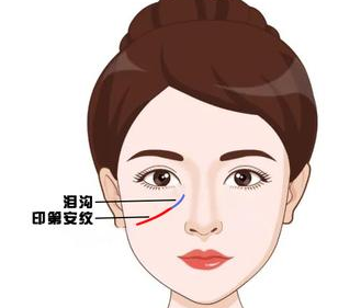 眼袋