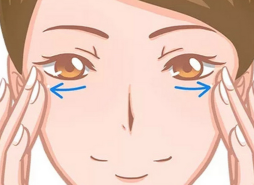 眼袋
