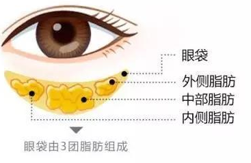 眼袋