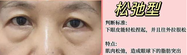 眼袋