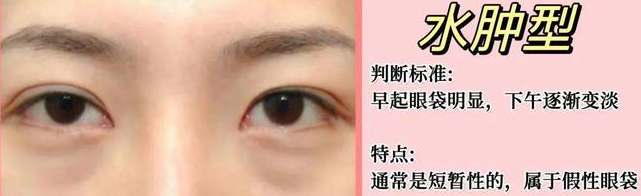 眼袋