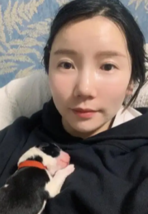 自体脂肪填充