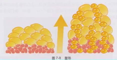 自体脂肪丰胸