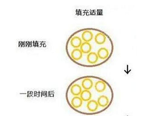 自体脂肪丰胸