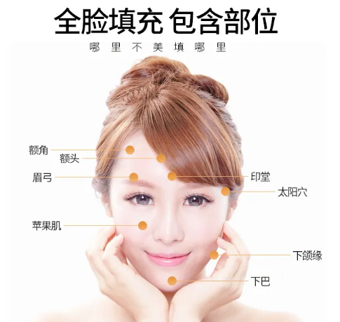 自体脂肪填充