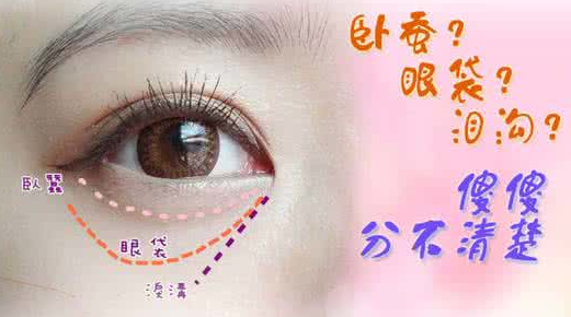 眼袋手术