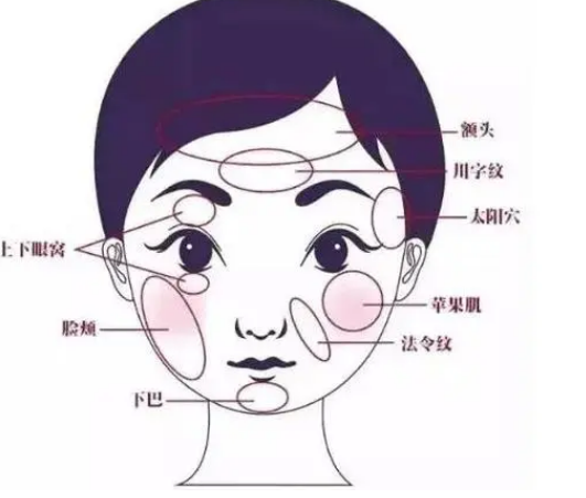 自体脂肪填充