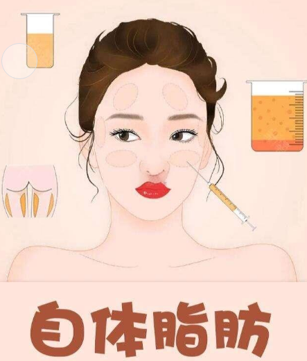 自体脂肪填充