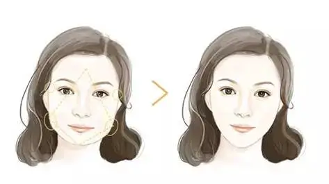 自体脂肪填充