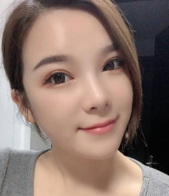 自体脂肪填充