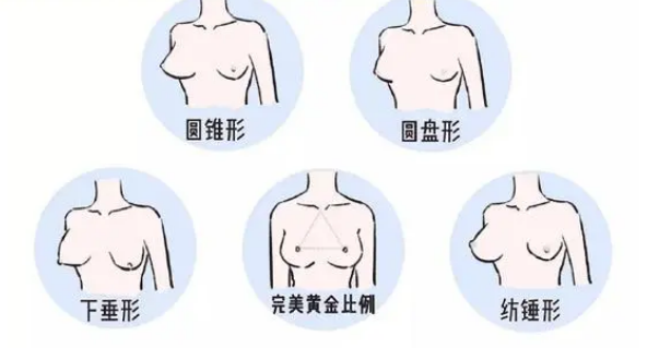 自体脂肪丰胸