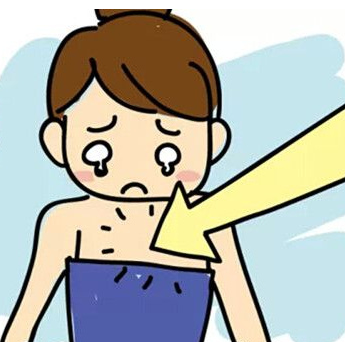 自体脂肪丰胸