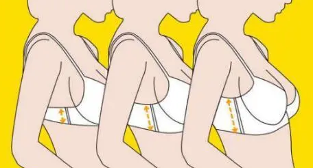 自体脂肪丰胸