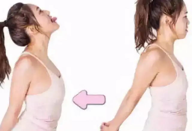 自体脂肪丰胸