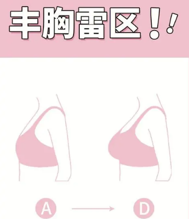 自体脂肪丰胸