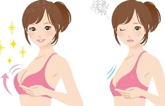 自体脂肪丰胸