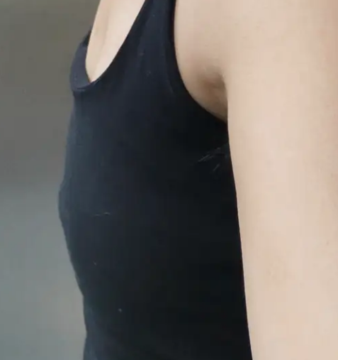 自体脂肪丰胸