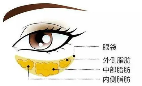 黑眼圈