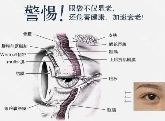 黑眼圈