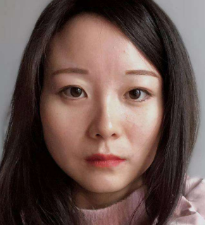 眼袋手术