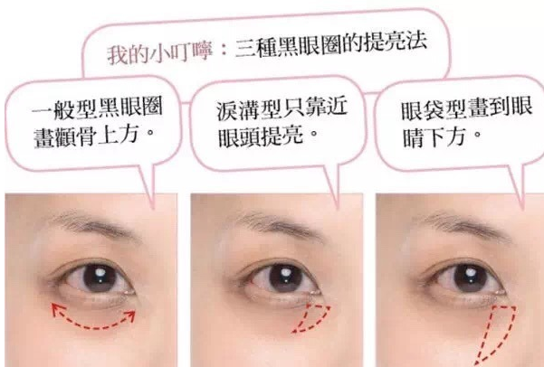 眼袋