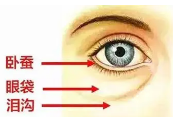 眼袋