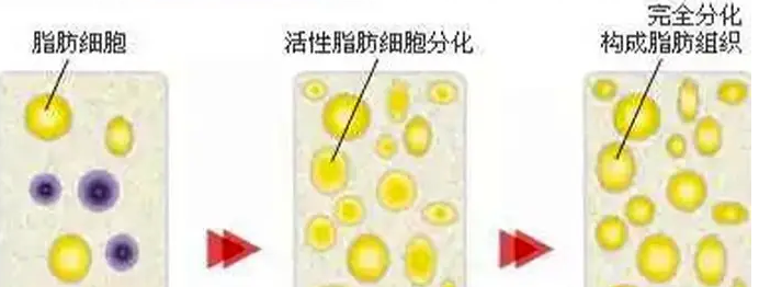 自体脂肪丰胸