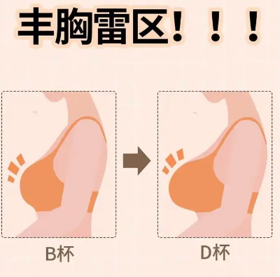 自体脂肪丰胸
