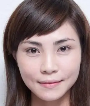 眼袋