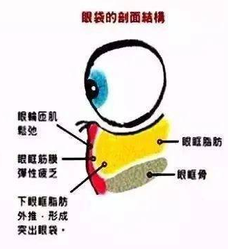 眼袋
