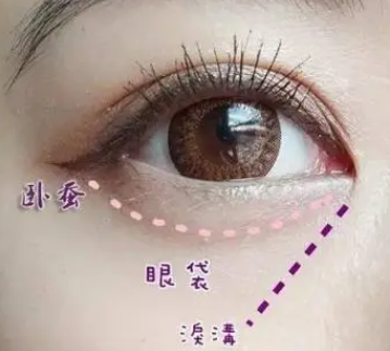 眼袋
