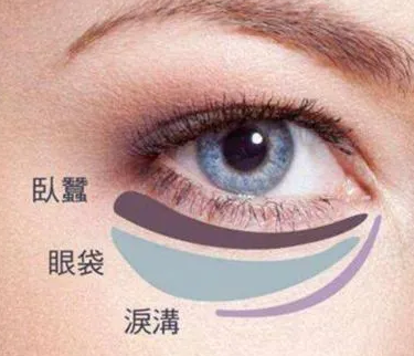眼袋