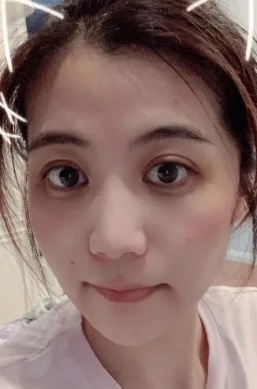 眼袋