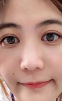 眼袋